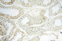 EHBP1 Rabbit anti-Human, Mouse, Rat, Polyclonal, Proteintech 150 &mu;L;