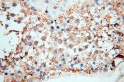 EHBP1 Rabbit anti-Human, Mouse, Rat, Polyclonal, Proteintech 150 &mu;L;