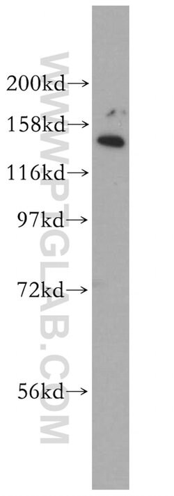 EHBP1 Rabbit anti-Human, Mouse, Rat, Polyclonal, Proteintech 150 &mu;L;