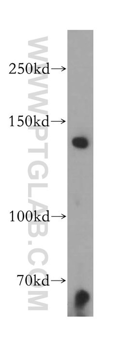 EHBP1 Rabbit anti-Human, Mouse, Rat, Polyclonal, Proteintech 150 &mu;L;
