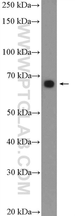 GRHL1 Rabbit anti-Human, Mouse, Rat, Polyclonal, Proteintech 150 &mu;L;