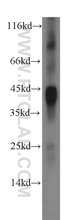 IL-12B Rabbit anti-Human, Polyclonal, Proteintech 150 &mu;L; Unconjugated:Antibodies,