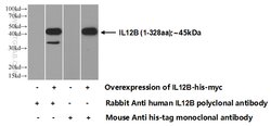 IL-12B Rabbit anti-Human, Polyclonal, Proteintech 150 &mu;L; Unconjugated:Antibodies,