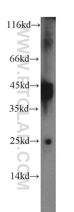 IL-12B Rabbit anti-Human, Polyclonal, Proteintech 150 &mu;L; Unconjugated:Antibodies,