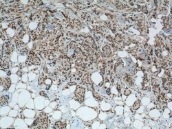 GTF3C4 Rabbit anti-Human, Mouse, Rat, Polyclonal, Proteintech 150 &mu;L;