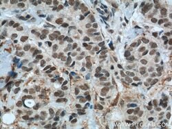 GTF3C4 Rabbit anti-Human, Mouse, Rat, Polyclonal, Proteintech 150 &mu;L;