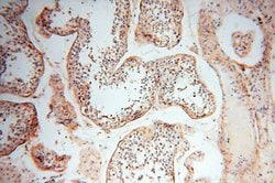 MFAP4 Rabbit anti-Human, Mouse, Rat, Polyclonal, Proteintech:Antibodies:Primary
