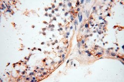 MFAP4 Rabbit anti-Human, Mouse, Rat, Polyclonal, Proteintech:Antibodies:Primary