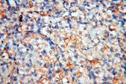 MFAP4 Rabbit anti-Human, Mouse, Rat, Polyclonal, Proteintech:Antibodies:Primary