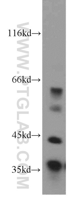 MFAP4 Rabbit anti-Human, Mouse, Rat, Polyclonal, Proteintech:Antibodies:Primary