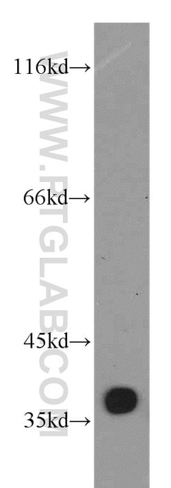 MFAP4 Rabbit anti-Human, Mouse, Rat, Polyclonal, Proteintech:Antibodies:Primary
