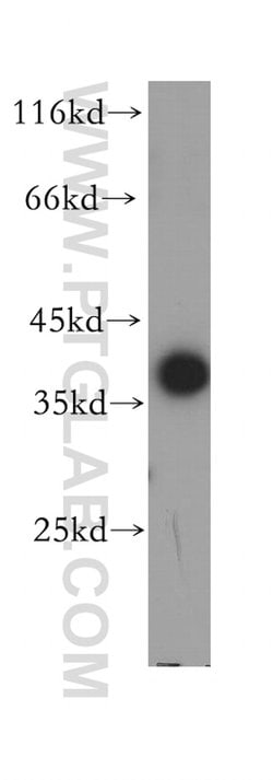 MFAP4 Rabbit anti-Human, Mouse, Rat, Polyclonal, Proteintech:Antibodies:Primary