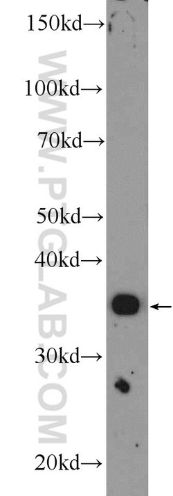 MFAP4 Rabbit anti-Human, Mouse, Rat, Polyclonal, Proteintech:Antibodies:Primary