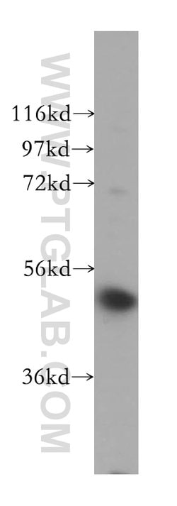 VPS4B Rabbit anti-Human, Mouse, Rat, Polyclonal, Proteintech:Antibodies:Primary