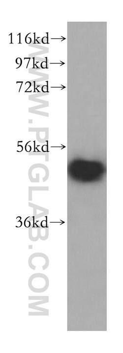 VPS4B Rabbit anti-Human, Mouse, Rat, Polyclonal, Proteintech:Antibodies:Primary