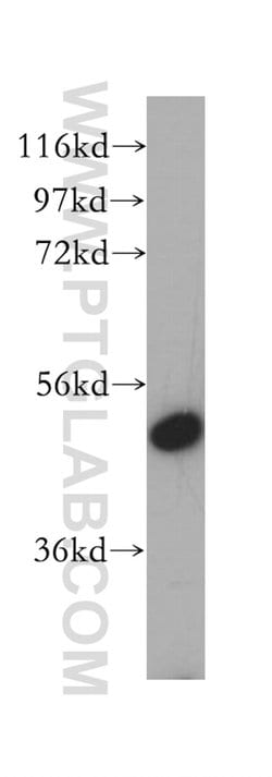 VPS4B Rabbit anti-Human, Mouse, Rat, Polyclonal, Proteintech:Antibodies:Primary