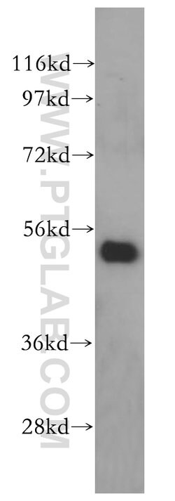 VPS4B Rabbit anti-Human, Mouse, Rat, Polyclonal, Proteintech:Antibodies:Primary