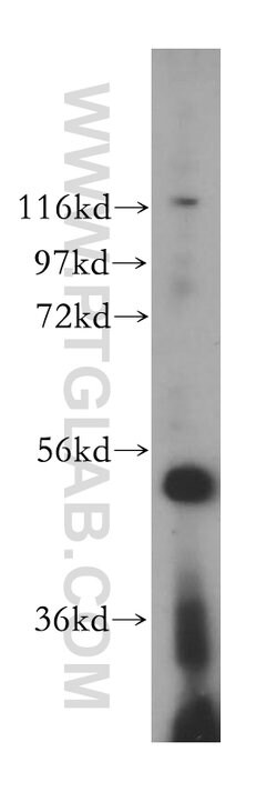 VPS4B Rabbit anti-Human, Mouse, Rat, Polyclonal, Proteintech:Antibodies:Primary
