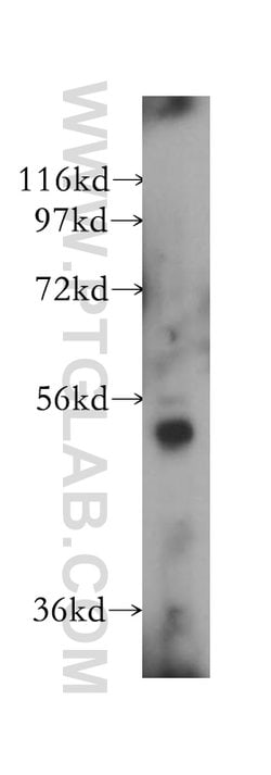 VPS4B Rabbit anti-Human, Mouse, Rat, Polyclonal, Proteintech:Antibodies:Primary