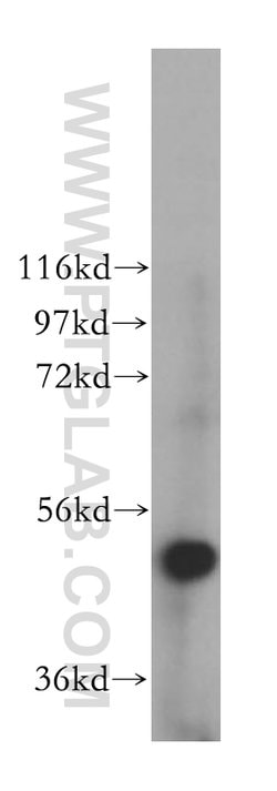 VPS4B Rabbit anti-Human, Mouse, Rat, Polyclonal, Proteintech:Antibodies:Primary