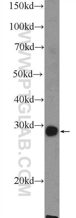 MSX1 Rabbit anti-Human, Mouse, Rat, Polyclonal, Proteintech 150 &mu;L;