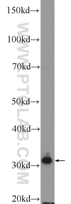 MSX1 Rabbit anti-Human, Mouse, Rat, Polyclonal, Proteintech 150 &mu;L;