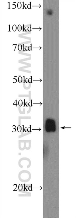MSX1 Rabbit anti-Human, Mouse, Rat, Polyclonal, Proteintech 150 &mu;L;