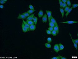 SH3BP4 Rabbit anti-Human, Mouse, Rat, Polyclonal, Proteintech:Antibodies:Primary