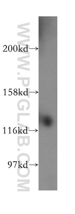 SH3BP4 Rabbit anti-Human, Mouse, Rat, Polyclonal, Proteintech