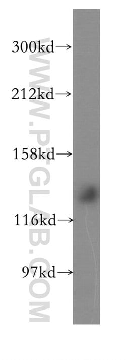 SH3BP4 Rabbit anti-Human, Mouse, Rat, Polyclonal, Proteintech:Antibodies:Primary