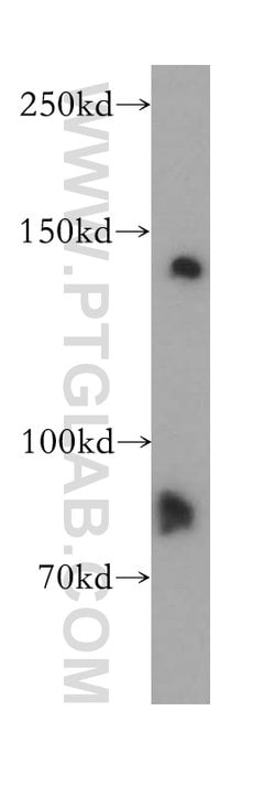 MAN2B2 Rabbit anti-Human, Mouse, Rat, Polyclonal, Proteintech 150 &mu;L;