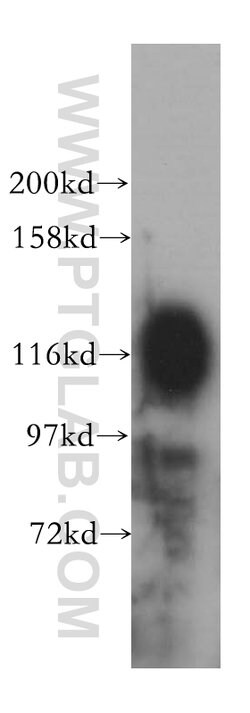 ICAM3 Rabbit anti-Human, Polyclonal, Proteintech 150 &mu;L; Unconjugated:Antibodies,