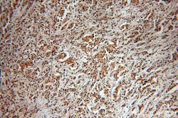 USP28 Rabbit anti-Human, Mouse, Rat, Polyclonal, Proteintech:Antibodies:Primary