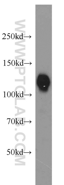 USP28 Rabbit anti-Human, Mouse, Rat, Polyclonal, Proteintech:Antibodies:Primary