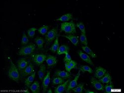 CSK Rabbit anti-Human, Polyclonal, Proteintech 150 &mu;L; Unconjugated:Antibodies,