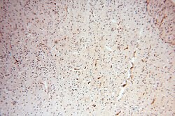 CSK Rabbit anti-Human, Polyclonal, Proteintech 150 &mu;L; Unconjugated:Antibodies,