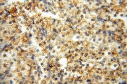CSK Rabbit anti-Human, Polyclonal, Proteintech 150 &mu;L; Unconjugated:Antibodies,