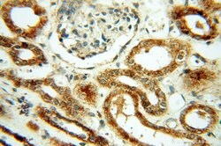 CSK Rabbit anti-Human, Polyclonal, Proteintech 150 &mu;L; Unconjugated:Antibodies,