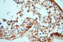 CSK Rabbit anti-Human, Polyclonal, Proteintech 150 &mu;L; Unconjugated:Antibodies,