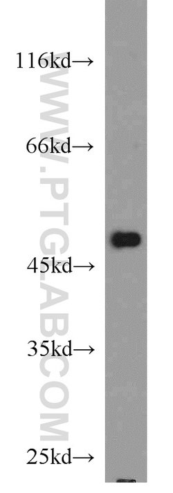 CSK Rabbit anti-Human, Polyclonal, Proteintech 150 &mu;L; Unconjugated:Antibodies,