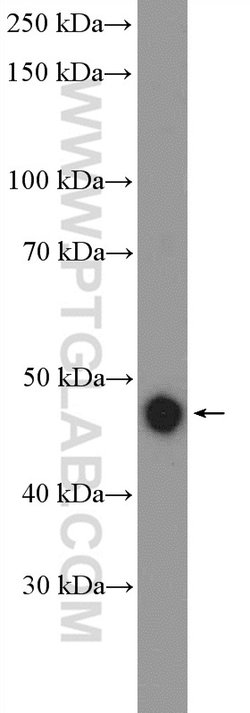 CSK Rabbit anti-Human, Polyclonal, Proteintech 150 &mu;L; Unconjugated:Antibodies,