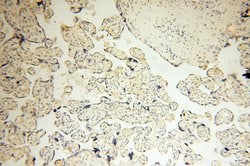 SMARCC1 Rabbit anti-Human, Mouse, Rat, Polyclonal, Proteintech 150 &mu;L;