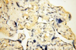 SMARCC1 Rabbit anti-Human, Mouse, Rat, Polyclonal, Proteintech 150 &mu;L;