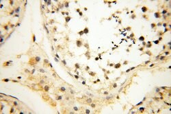 SMARCC1 Rabbit anti-Human, Mouse, Rat, Polyclonal, Proteintech 150 &mu;L;
