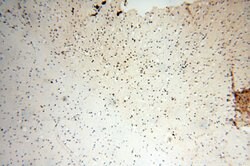 SMARCC1 Rabbit anti-Human, Mouse, Rat, Polyclonal, Proteintech 150 &mu;L;