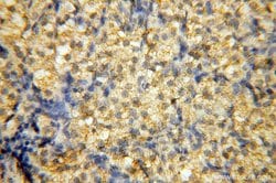 SMARCC1 Rabbit anti-Human, Mouse, Rat, Polyclonal, Proteintech 150 &mu;L;