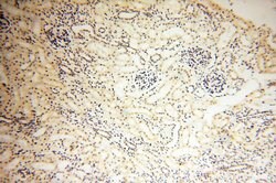 SMARCC1 Rabbit anti-Human, Mouse, Rat, Polyclonal, Proteintech 150 &mu;L;