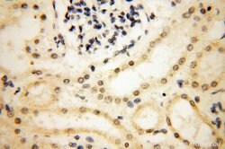 SMARCC1 Rabbit anti-Human, Mouse, Rat, Polyclonal, Proteintech 150 &mu;L;