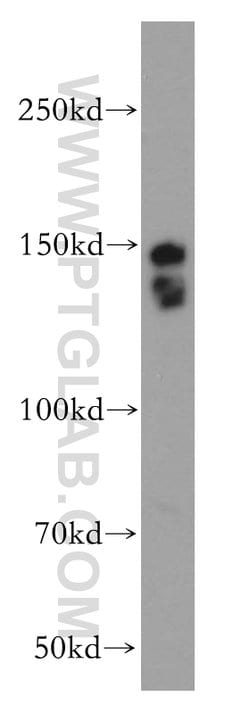 SMARCC1 Rabbit anti-Human, Mouse, Rat, Polyclonal, Proteintech 150 &mu;L;