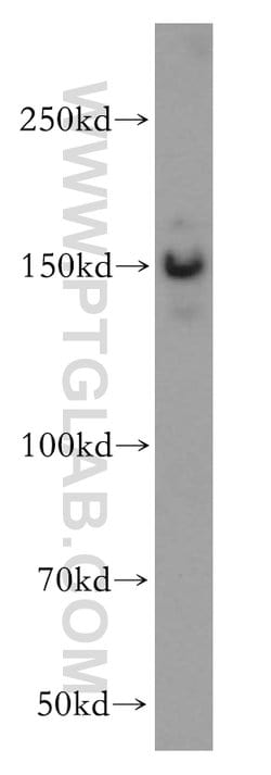 SMARCC1 Rabbit anti-Human, Mouse, Rat, Polyclonal, Proteintech 150 &mu;L;